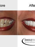 Smile More Today