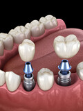 Bella Vida Dental